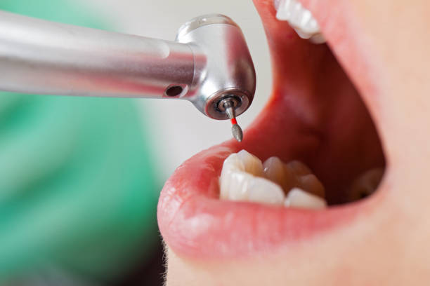 Best Emergency Wisdom Teeth Removal in Cypress Landing, NC